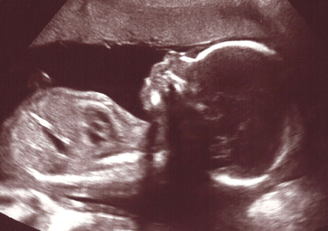 Home Precious Moments Baby Scans Newport Wales Precious Moments